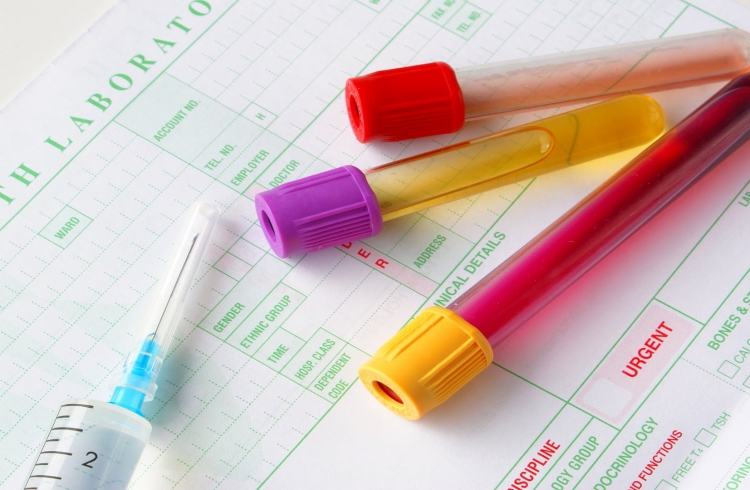 Đi tiểu ra máu liệu có nguy hiểm? Đi tiểu ra máu liệu có nguy hiểm?